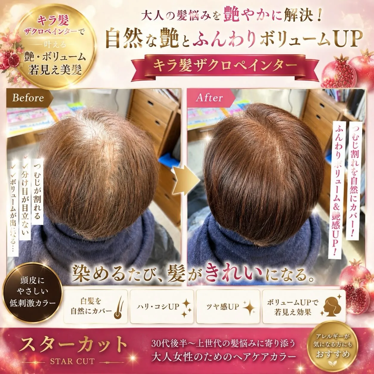 【トップのボリューム、諦めてませんか？】